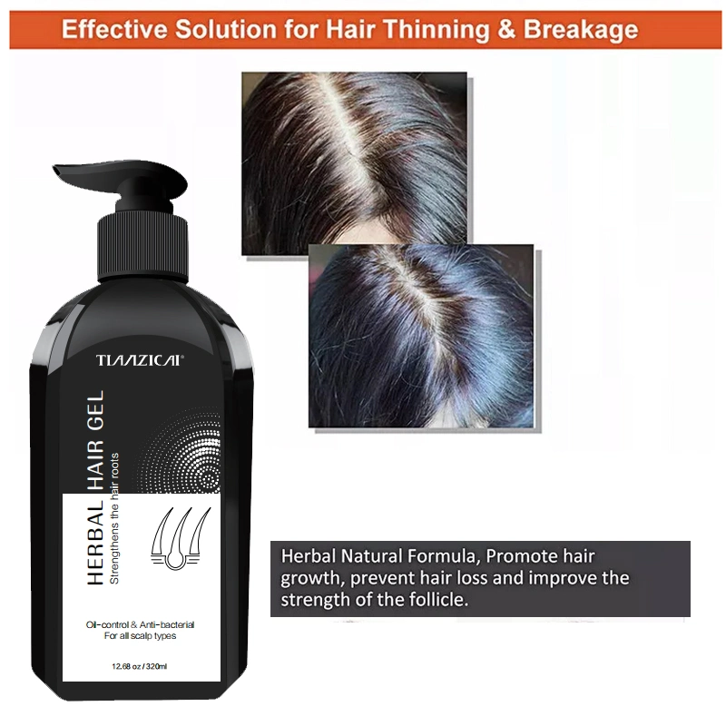 Hair Care Hydrating Hair Shampoo Anti Hair Loss Shampoo for Hair Regrowth Shampoo Soap